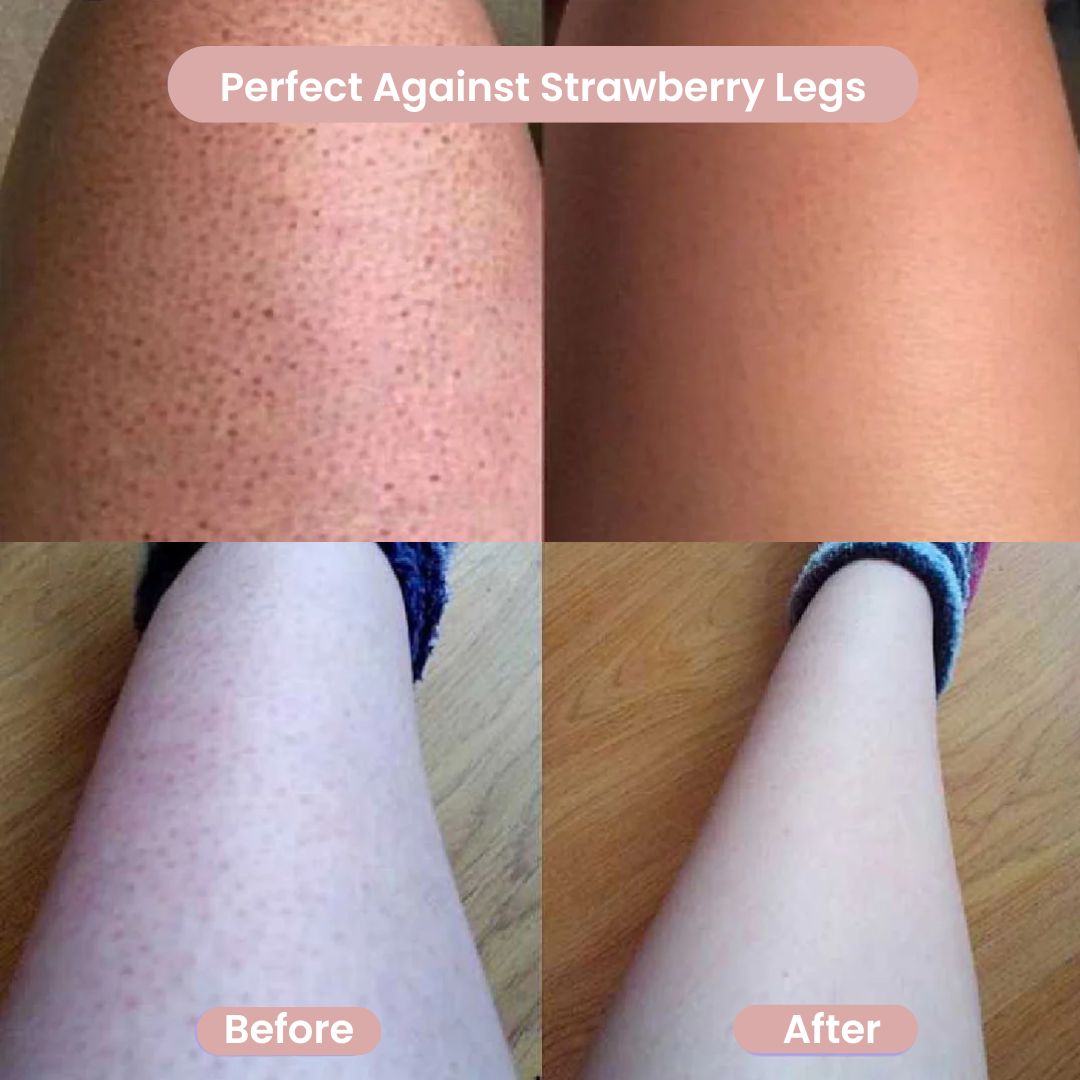 Before and after results showing GlowShave 2-in-1 body shaver reducing strawberry legs for smooth, irritation-free skin.