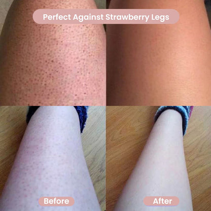 Before and after results showing GlowShave 2-in-1 body shaver reducing strawberry legs for smooth, irritation-free skin.